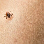 What Are The Most Common Pest Control Issues for Homeowners